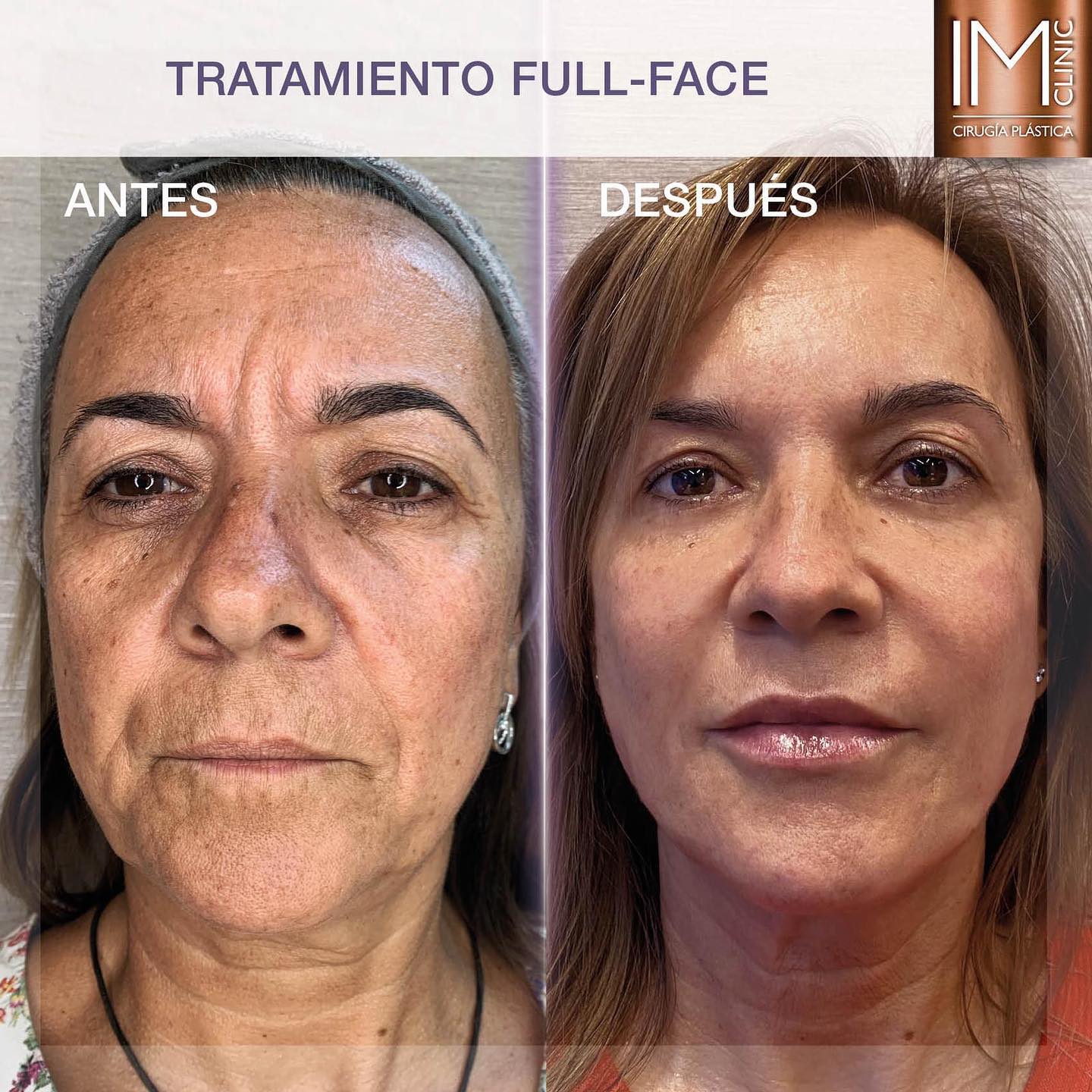 fullface_imclinic